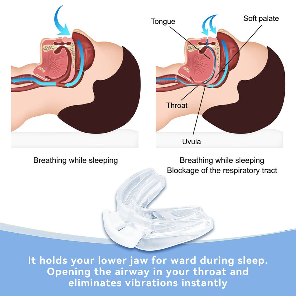 Adjustable Anti Snoring Bruxism Mouth Guard Anti-Snoring